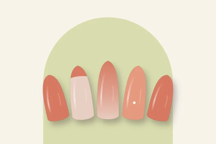 Ongles en gel corail : couleur pleine, french corail, dégradé et point blanc
